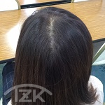 Before画像