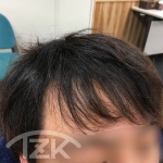 Before画像